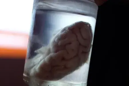 Brain in a jar